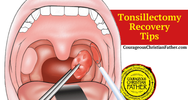 Tonsillectomy Recovery Tips