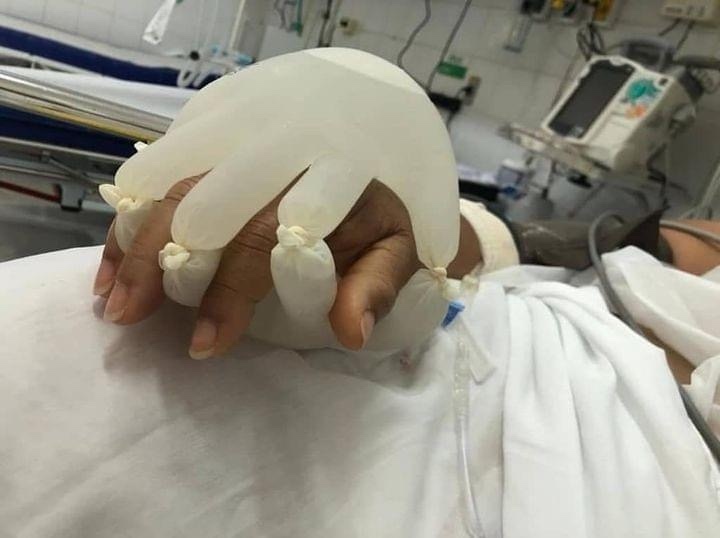 The Hand of God - With COIVD-19 it changed having guest or visitors for those needing surgeries or hospitalization. That is when some medical staff got creative using hot water and disposable gloves. #HandofGod #Brazil
